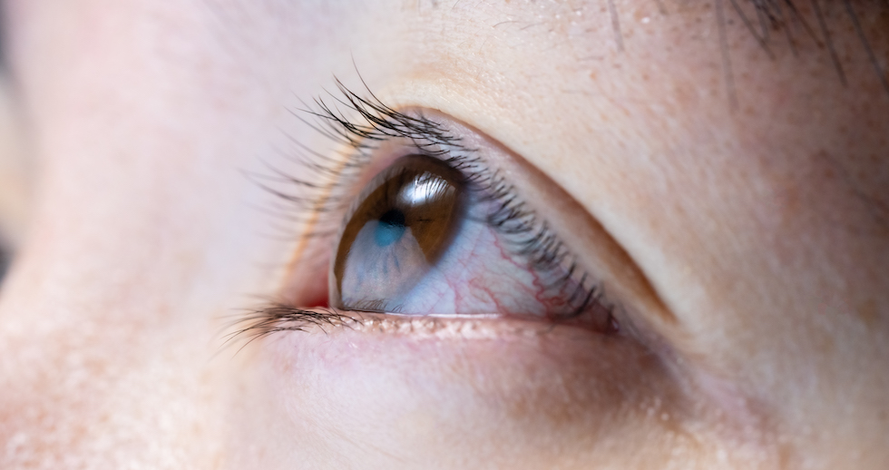 目の痙攣（けいれん）には要注意  このビタミンが足りていないかもしれません