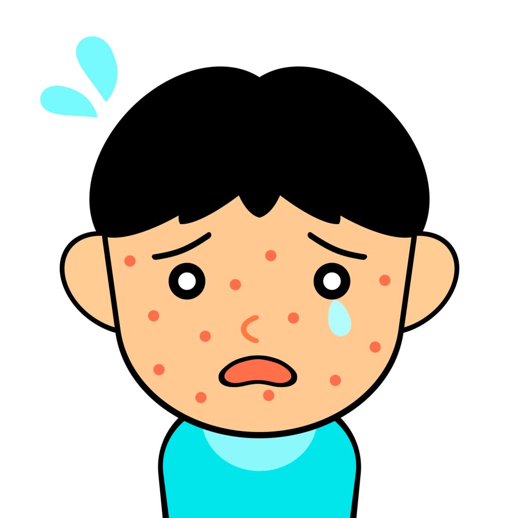 帯状疱疹の原因