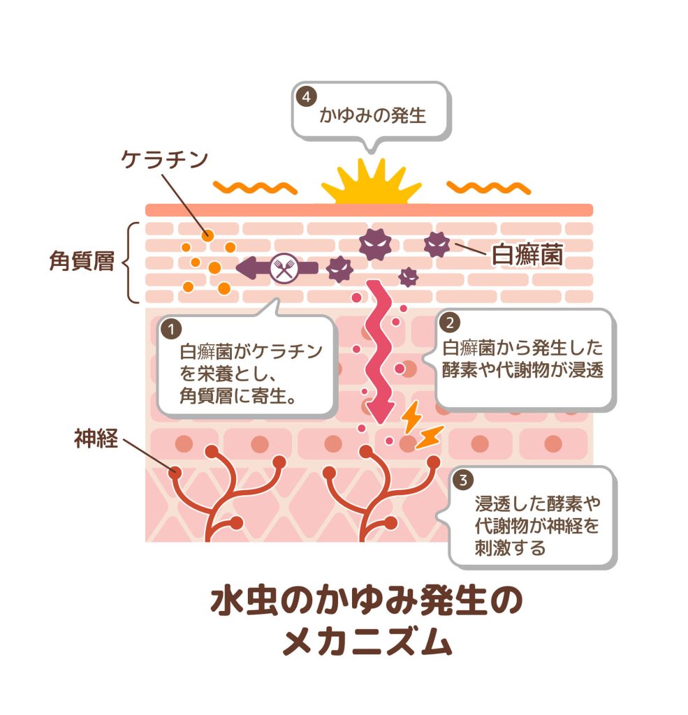 水虫の原因
