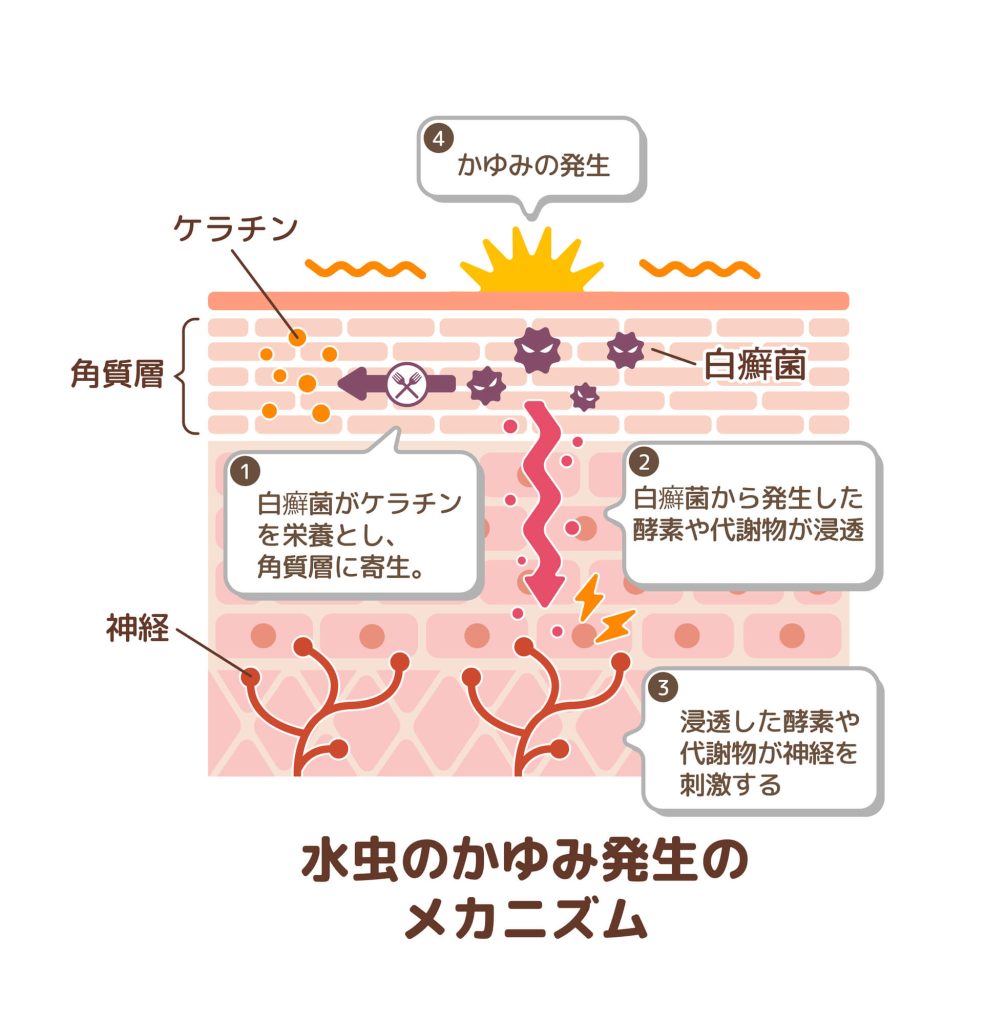 水虫の原因