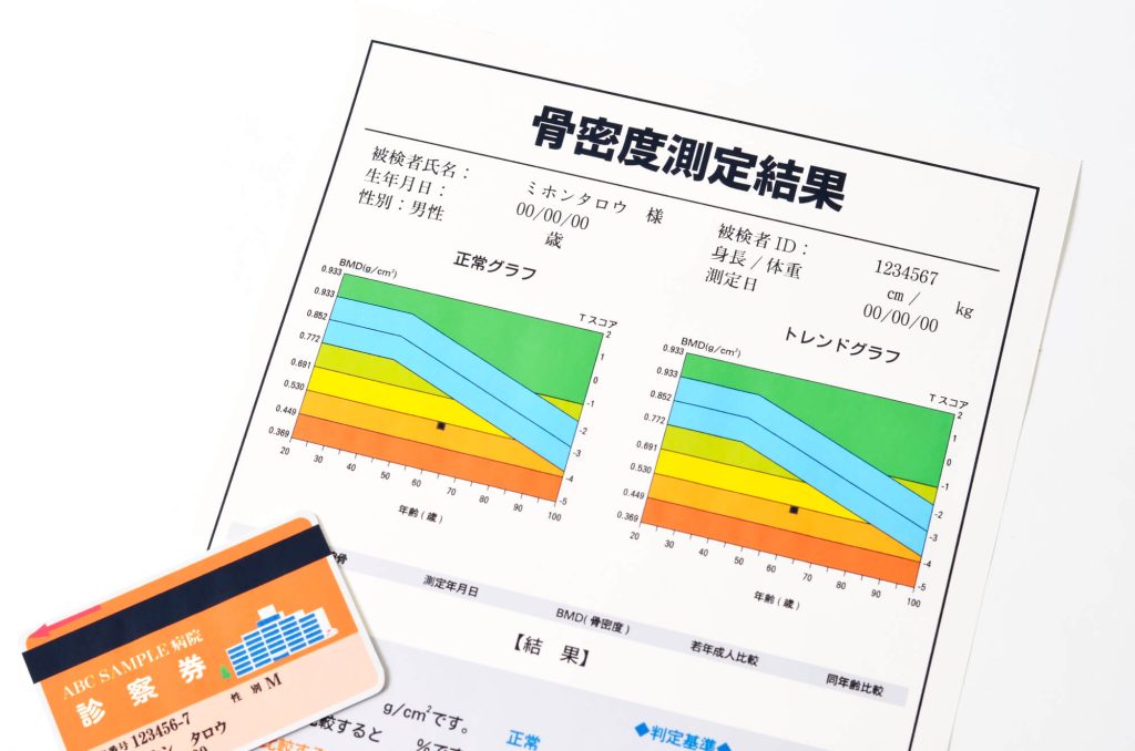 骨粗鬆症の検査